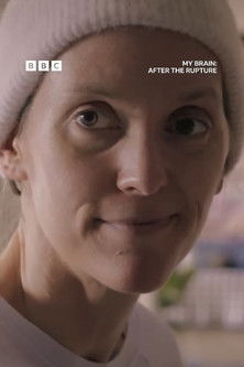 Watch Free My Brain After the Rupture (2025)
