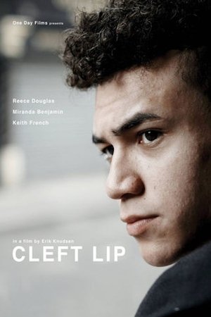 Watch Free Cleft Lip (2018)