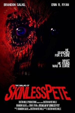Watch Free Skinless (2013)