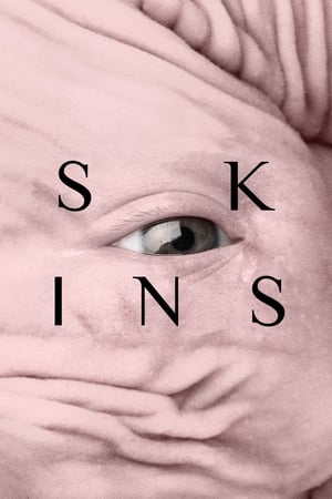 Watch Free Skins (2017)