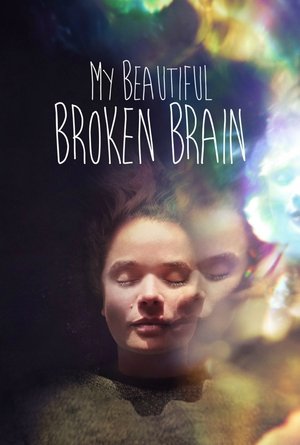 Watch Free My Beautiful Broken Brain (2014)