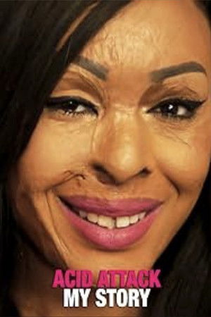 Watch Free Acid Attack My Story (2018)